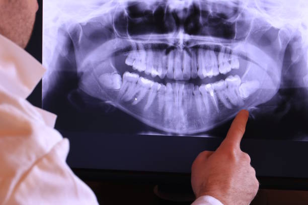 Best Emergency Dentist for Knocked-Out Tooth in Mentone, IN